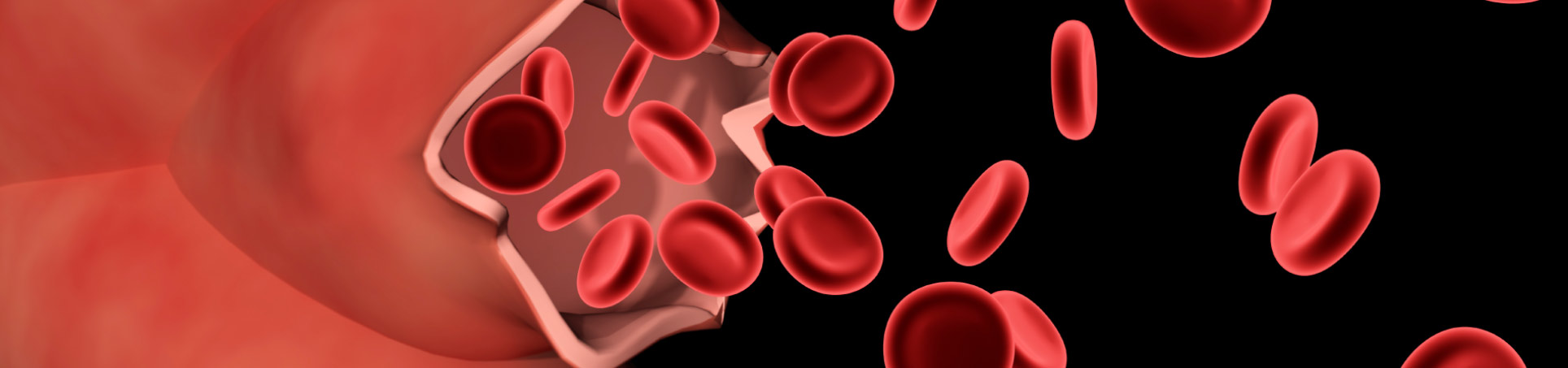 Aneurysmal Pathology Foundation